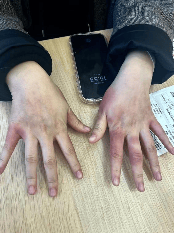 皇冠mos066_东北姑娘来浙江后崩溃了皇冠mos066，穿3条加绒裤还冻到发抖！南方人冬天怎么保命，网友吵翻！